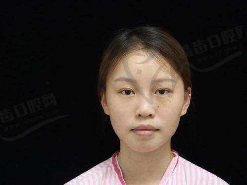 黄烨华院长擅长项目