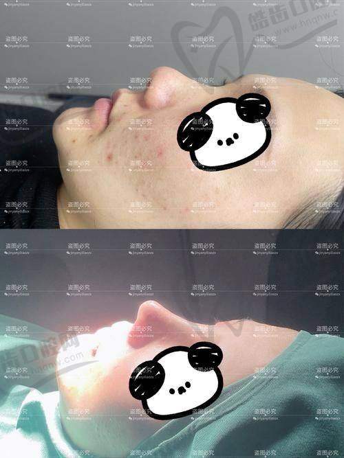 黄烨华院长预约挂号