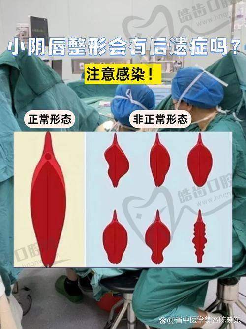 北京侯智慧医生联系方式揭晓,为您的私密整形手术提供可靠保障!