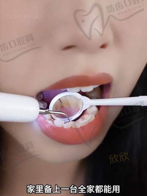 叶绵俊医生擅长的口腔项目