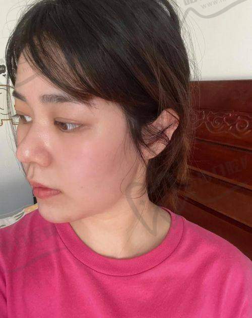 黄烨华院长技术优势