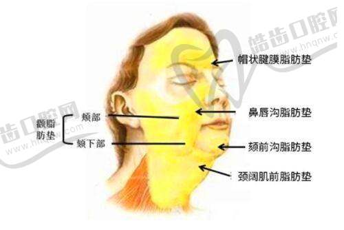 颊脂垫摘了后还能用脂肪填充回来吗之自体脂肪填充的可行性