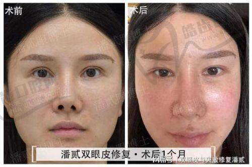 曾翾医生口碑评价及真人实例