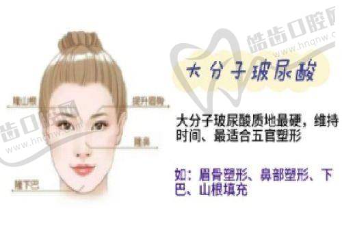 上海美姿医疗美容医院详细的预约挂号方式及流程