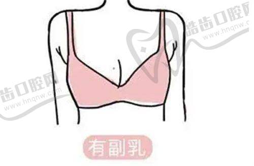 颏成型术和假体垫下巴有啥区别，下巴短还后缩该选谁