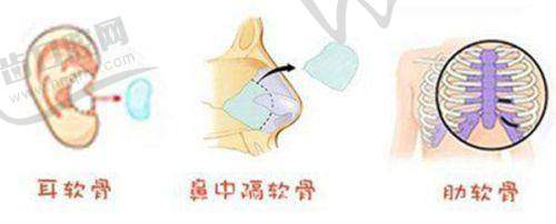 上海美姿医疗美容医院特色项目及技术优势