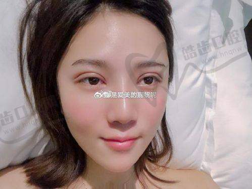 上海美姿整形李勇医生预约挂号