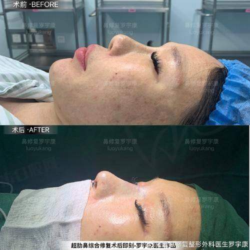 上海美姿整形李勇医生价格表