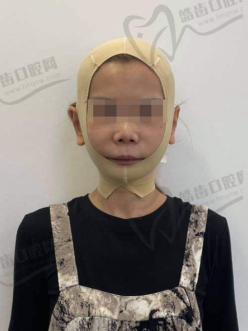 武汉同济医院筋膜提升三件套为何被称作“抗衰投资第一步”？