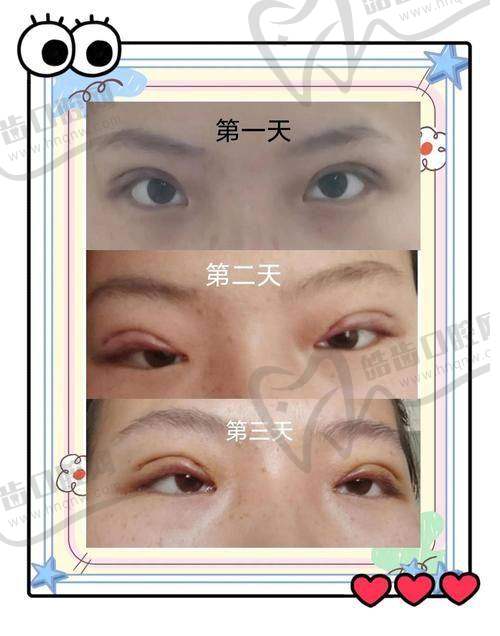 上海美姿整形李勇医生技术优势