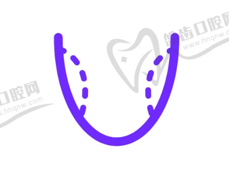 上海松丰口腔矫正的优势