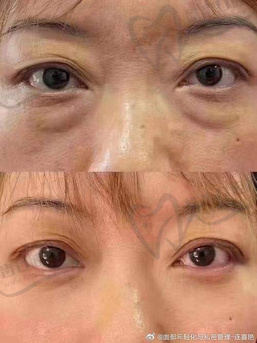张楚医生技术优势