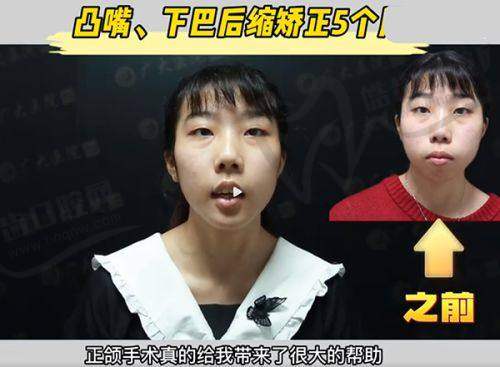 董岩岩医生在整形领域有什么专长？
