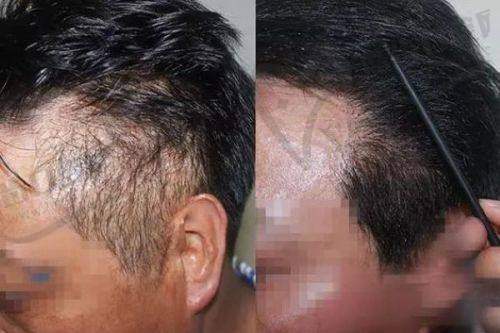 无锡DBC朵美整形医院怎么样，口碑评价如何？