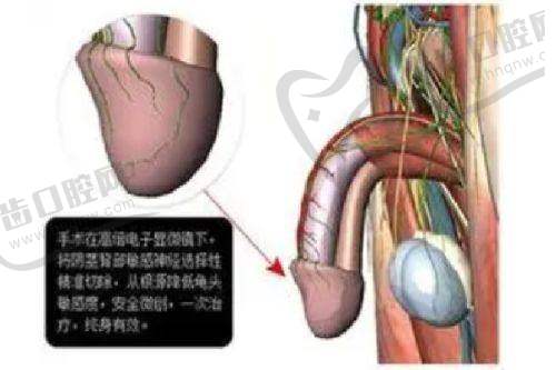 激光祛疤能完全去掉嗎——排名靠前值得選擇的醫(yī)院推薦