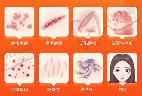 疤痕修复哪个医院更好？如何选择合适的医院