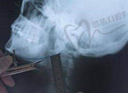 2025北京八大处整形医生介绍：拉皮手术推荐医生有哪些？