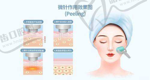 四、西安叶子整形外科与私密专享补贴：眼鼻胸与私密护理项目减免多多