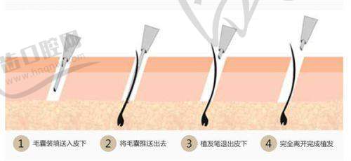 张春杰医生在执医过程中的荣誉