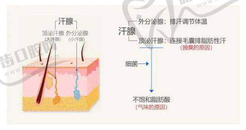 川字纹是打玻尿酸还是除皱针？——价格对比