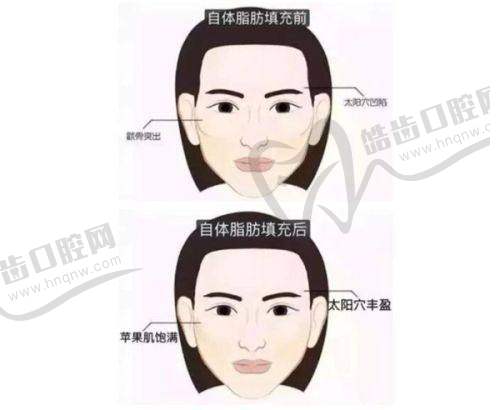 北京301解放军总医院整形美容价格表2025全新重磅一览：皮肤美容价格详情