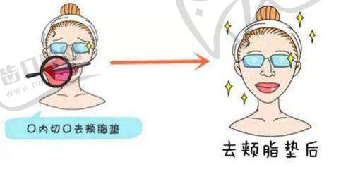 王慧文医生擅长的项目有哪些？
