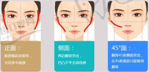 出彩医美十分钟隆胸是真是假及价格：真人实例见证成效