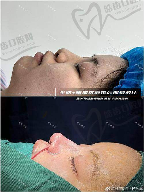 洪丽医生擅长的整形项目