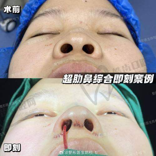 洪丽