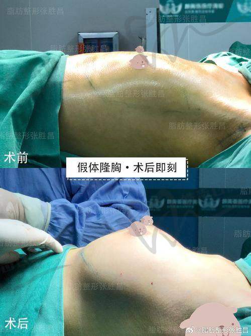 无锡尚美整形医院怎么样，口碑评价如何？