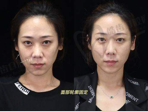郭晔医生的顾客整形好评