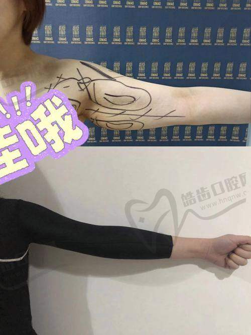 张金侠医生坐诊的无锡可琳雅整形医院