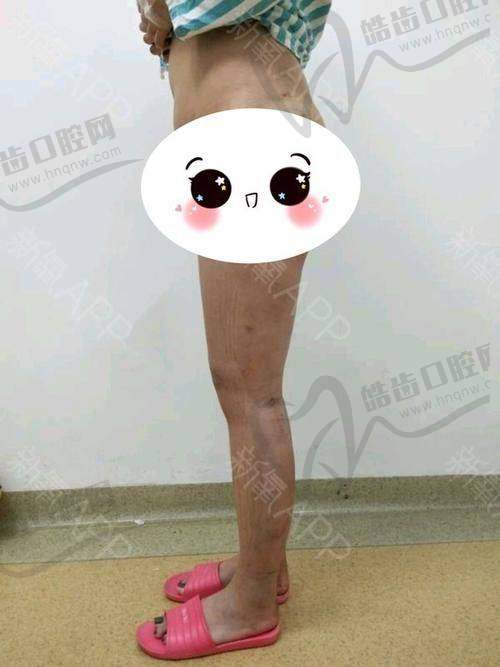 白俊杰医生的口碑评价及反馈内容