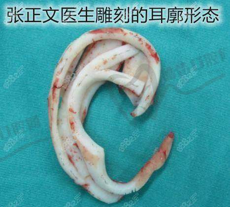无锡伊尔美整形美容医院项目特色