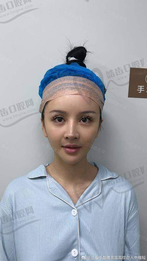 无锡DBC朵美整形医院价格表