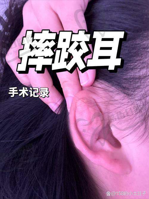 无锡伊尔美整形美容医院价格表