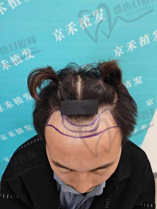 徐光才医生的口碑评价及反馈内容