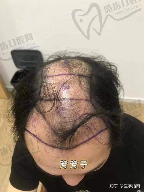 无锡宋悦医生的技术优势