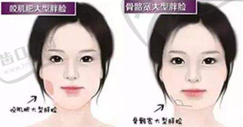 【2025男性生殖整形医生吕巍个人资料简介】——真人实例