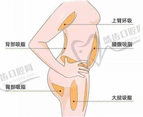 团圆口腔医院数字化种牙靠谱吗？技术优势显著