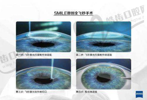 宁波爱尔光明眼科（江北诊所）真人口碑评价怎么样？