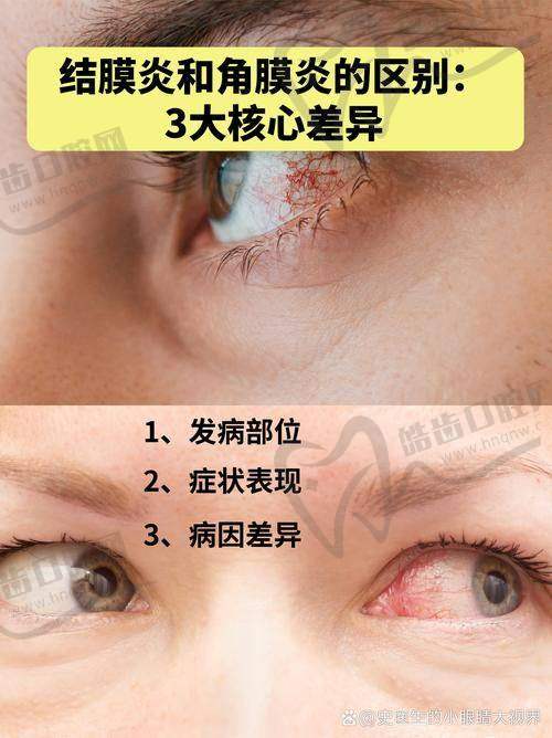 云南省邮电医院眼科怎么样，口碑评价如何