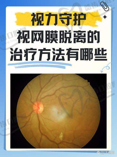 云南省交通中 心医院眼科项目特色