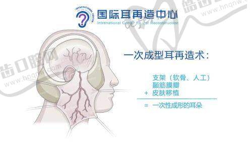 章庆国医生：仍在成都八大处医院亲自主刀耳再造，关键步骤绝不交给他人