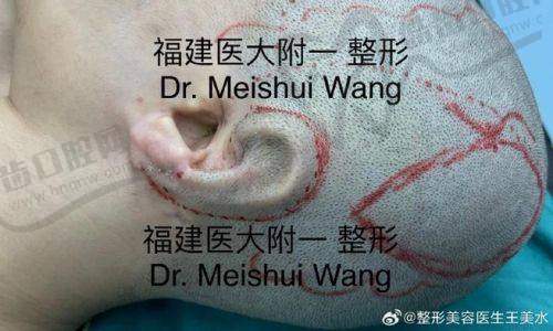 想找章庆国医生做耳再造手术？预约流程和小技巧这里请记牢