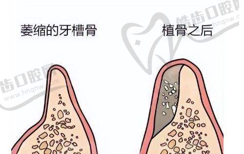 赵旭峰医生预约挂号