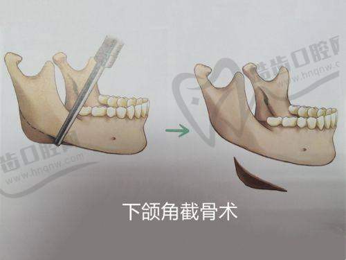 刘凯医生擅长项目