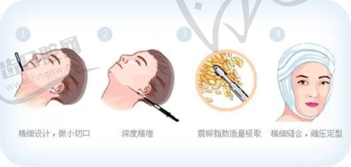 向平医生擅长的医美项目介绍