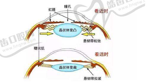 四、爱贝芙跟玻尿酸的区别