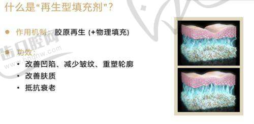 许锋美医生擅长项目